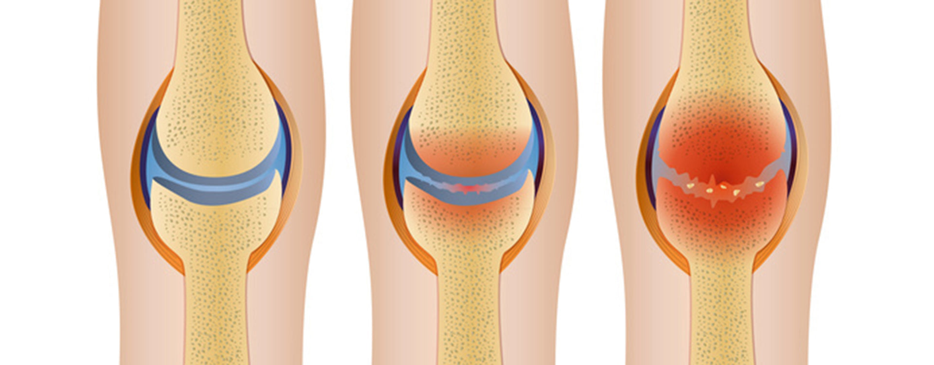 Forschung und Evidenz zu Hyaluronsäure